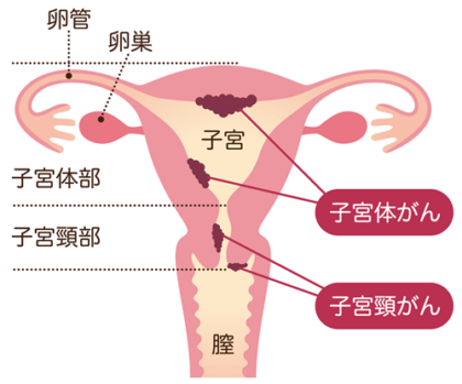 吹田市で予防接種(子宮頸がんワクチン)なら、たはらウィメンズクリニック│不妊治療・婦人科・女性内科